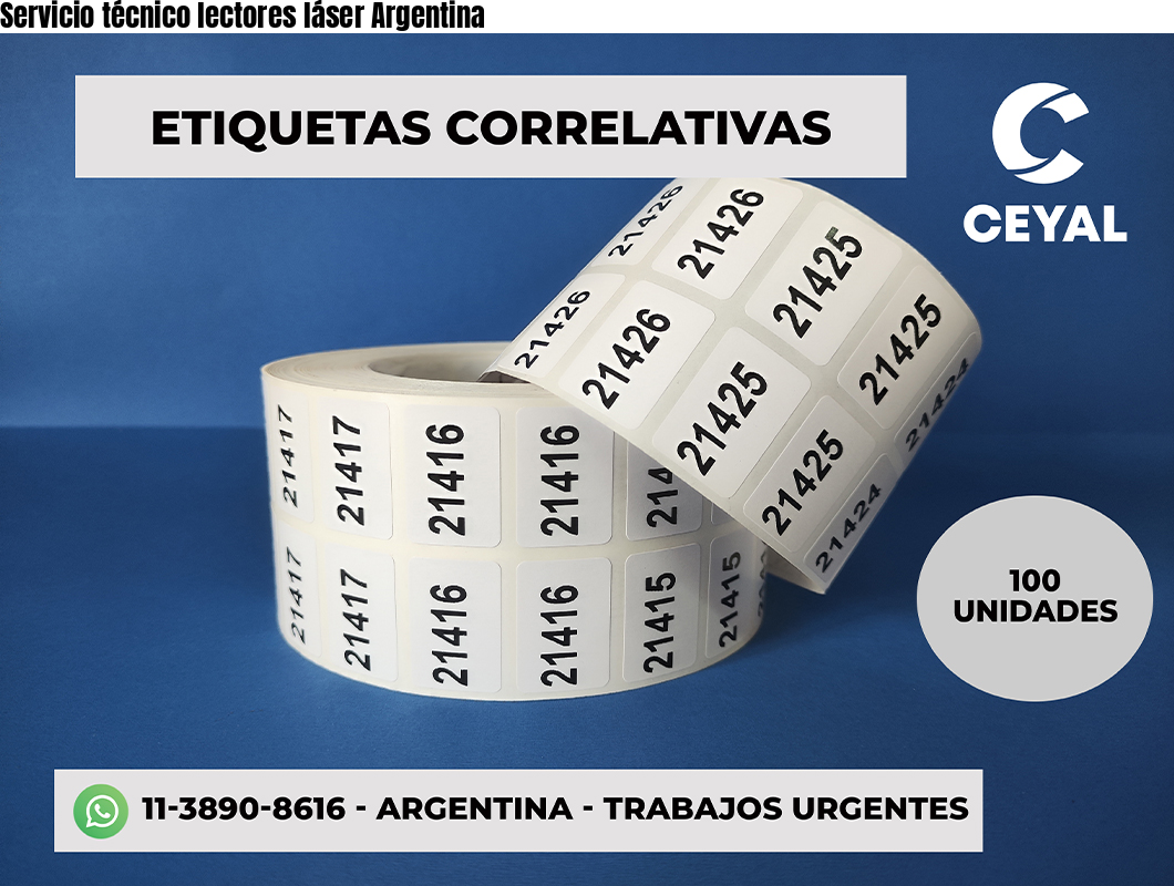 Servicio técnico lectores láser Argentina